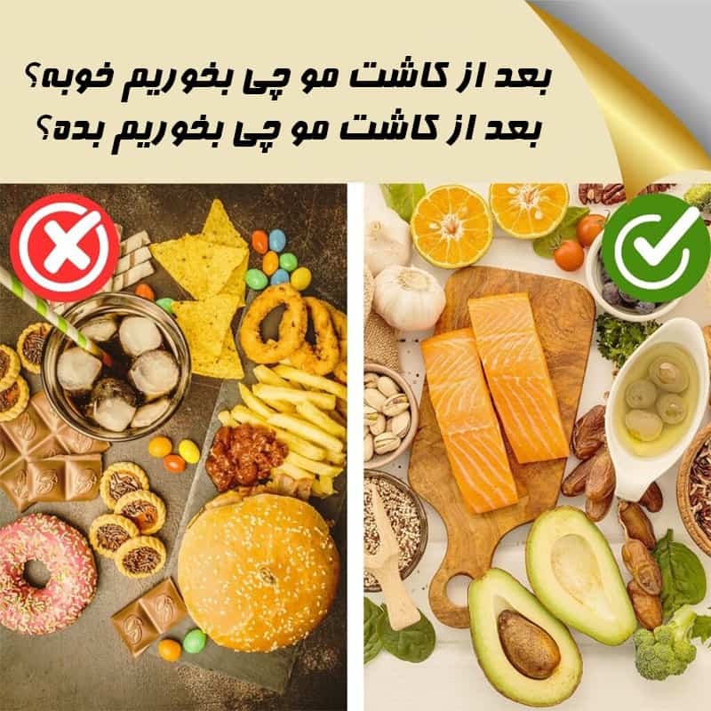 بعد از کاشت مو چی بخوریم؟